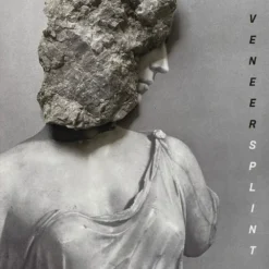 Veneer - Splint / vinyl